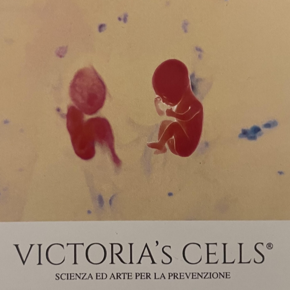 Victoria's Cells